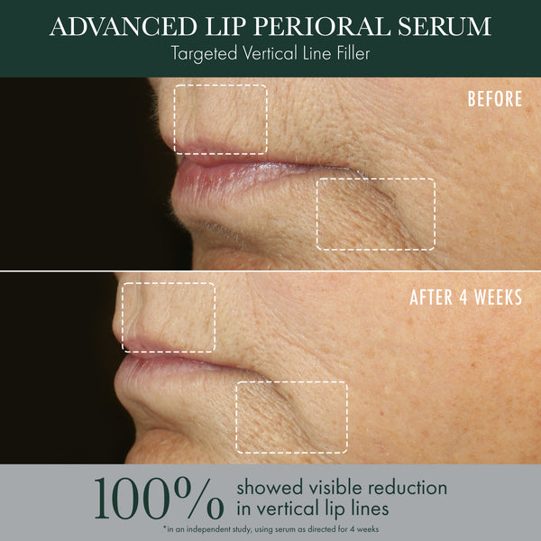 Advanced Lip Perioral Serum Before & After