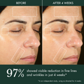 Hydrogel Moisturizer / Hyaluronic Acid Water Cream Before & After