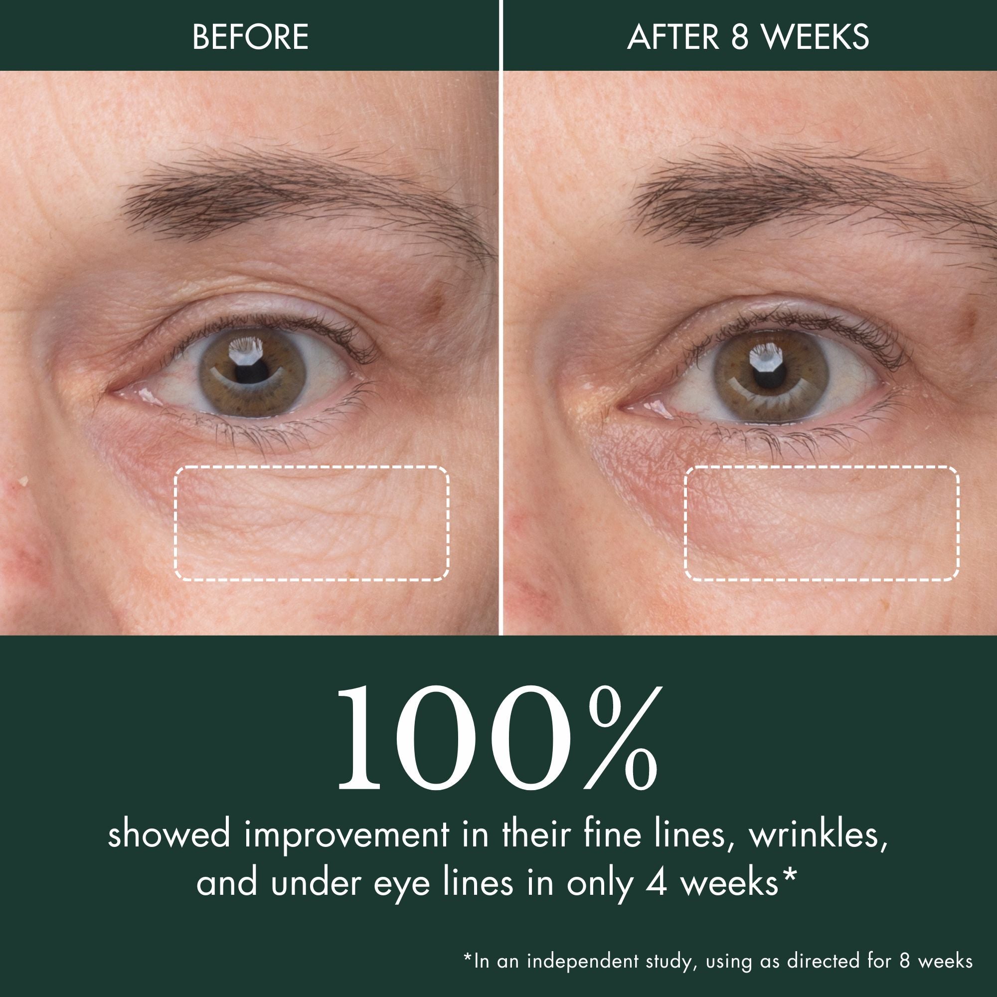 Peau Magnifique Eye Concentrate | Nightly Youth Renewal