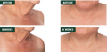 fermitif neck b&a